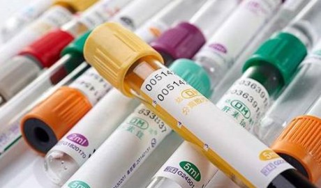 采血管內(nèi)壁促凝劑/抗凝劑噴涂